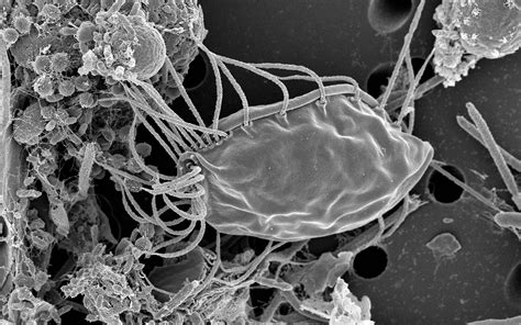  Heterotrichida: Ein pelziges Paradies für Mikrobenfresser?